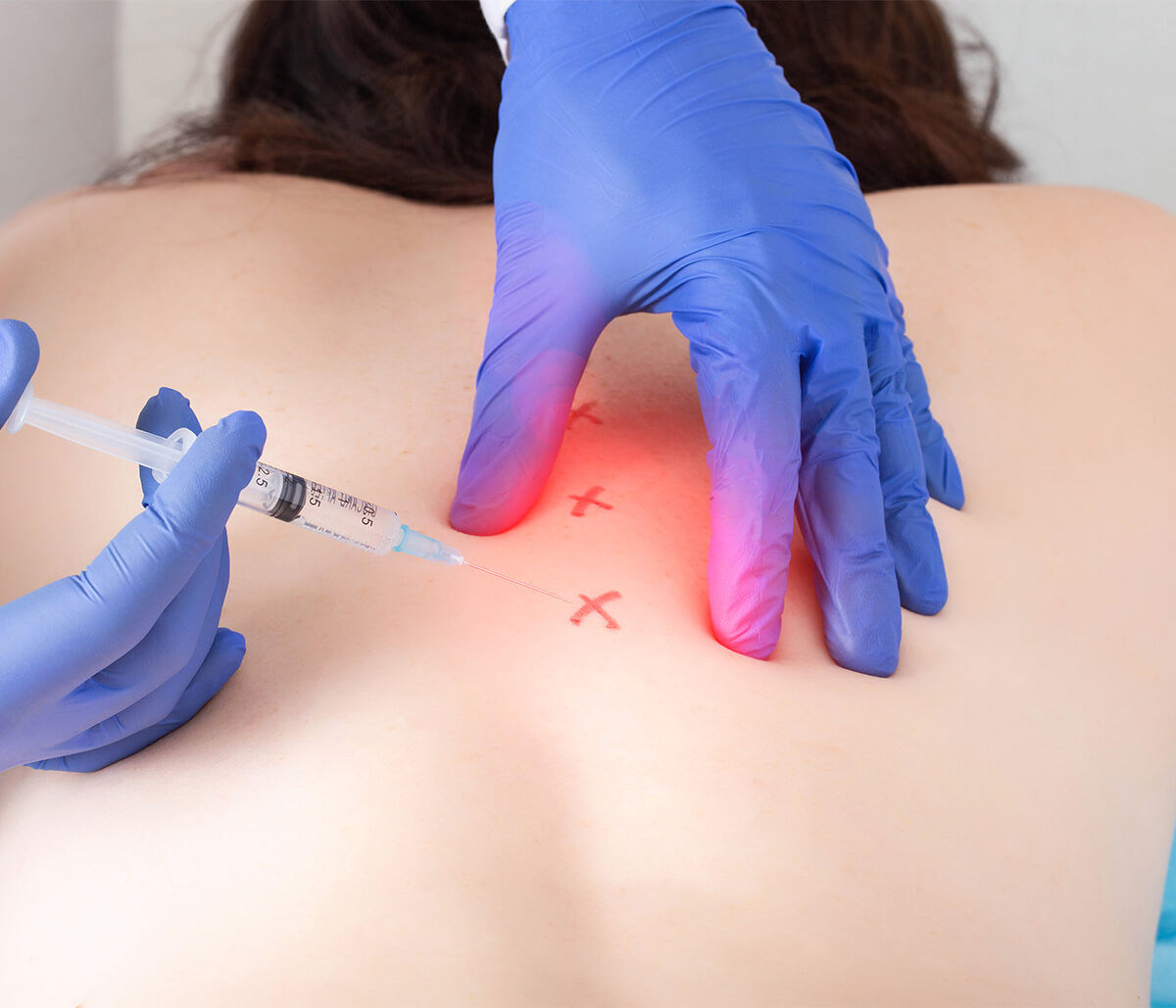 What Is The Trigger Point Injections Cost in Encinitas Area
